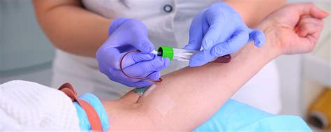 blood test drop in centre nottingham|Children’s Community Phlebotomy .